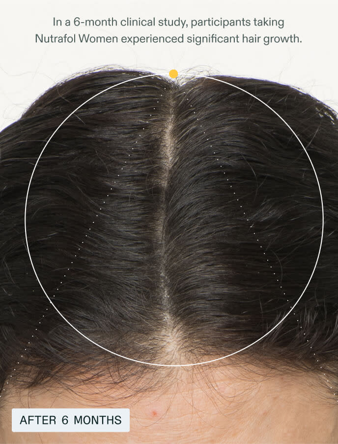 Women (Designed for women 18-44 experiencing hair thinning.)
