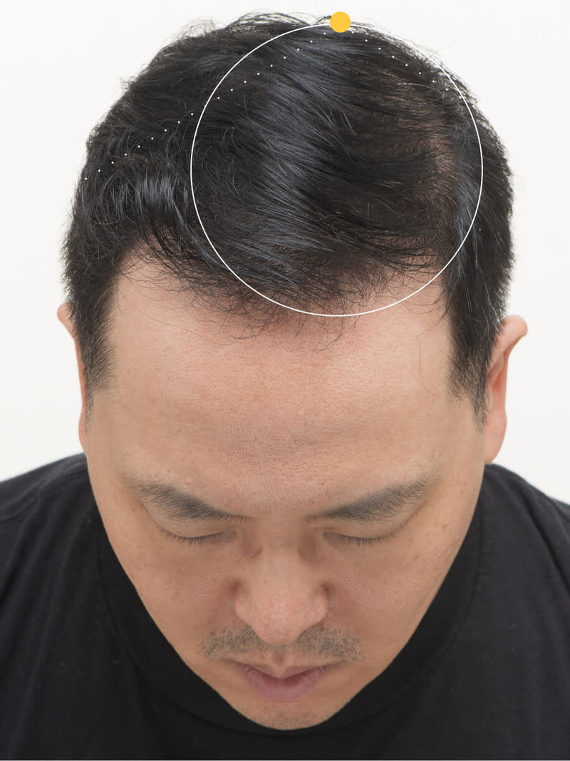 After