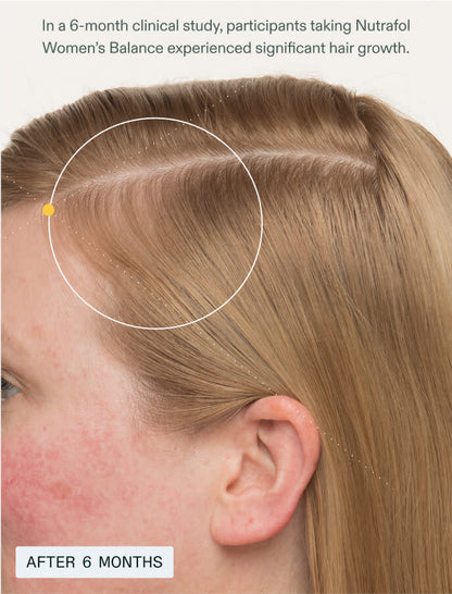 Women’s Balance (Designed for women 45+ experiencing hair thinning)