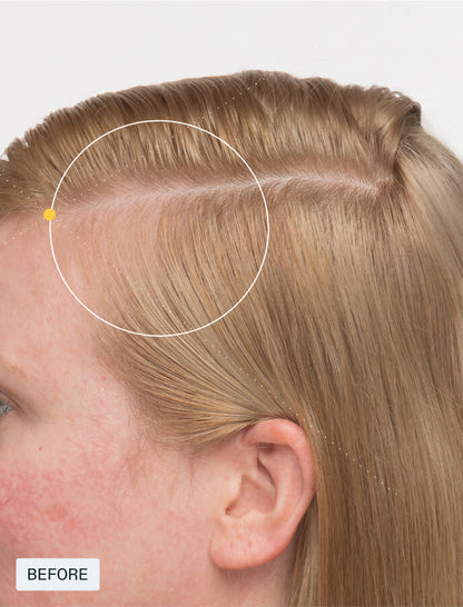 Women’s Balance (Designed for women 45+ experiencing hair thinning)